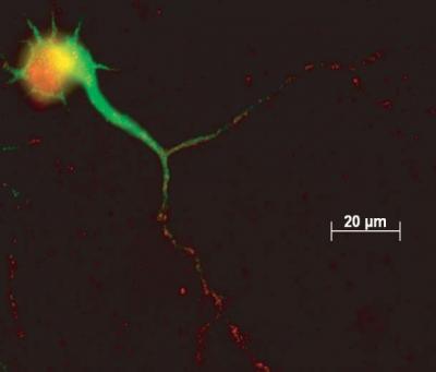 Transcription factor Elk-1's role in neurodegeneration and schizophrenia