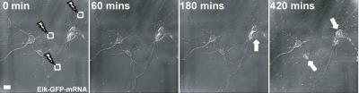 Transcription factor Elk-1's role in neurodegeneration and schizophrenia