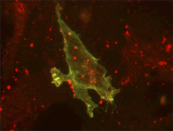 Disrupted Intercellular Communication Causes a Disfiguring Birth Defect