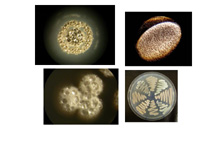 Study of antibiotic resistance in the soil help predict future clinical emergence