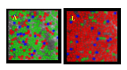 First-ever Images of Living Human Retinas Sprung a Surprise