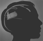 Responsive Neurostimulator System: An implantable device to treat epilepsy